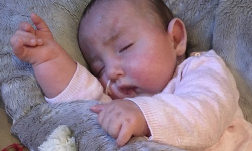 Opération cardiaque pour ma fille Jade