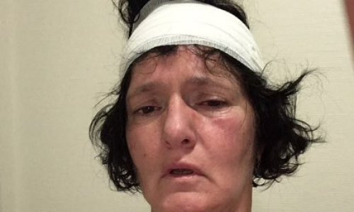 Protection envers les routiers