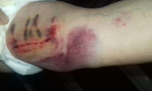 Alerte : Agressions de citoyens/propriétaires de chiens irresponsables