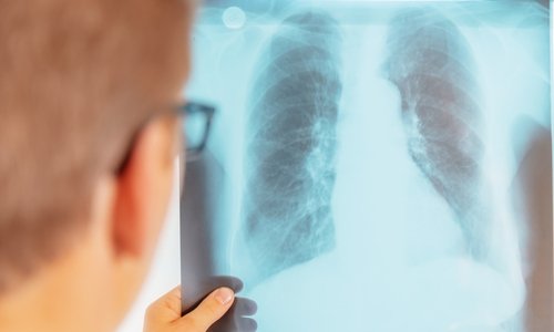 Soutien au Dr Meksen Brahim, pneumologue