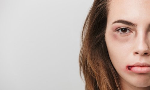 Plus de 100 femmes mortes sous les coups de leur conjoint en 2019