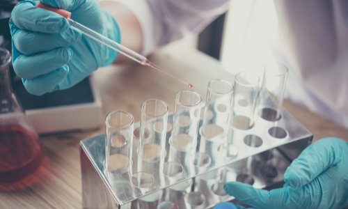 Appui à l'amélioration du traitement et l'augmentation des recherches sur le syndrome des jambes sans repos au Québec