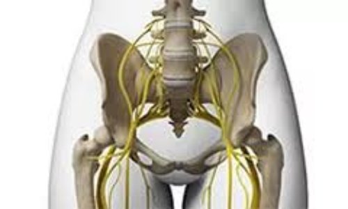 RECONNAISSANCE de la Névralgie Pudendale  - ALD