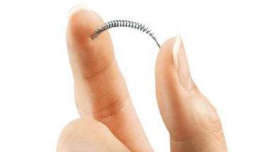 ESSURE : que la sécurité sociale avertisse les porteuses des dangers qu'il provoque !