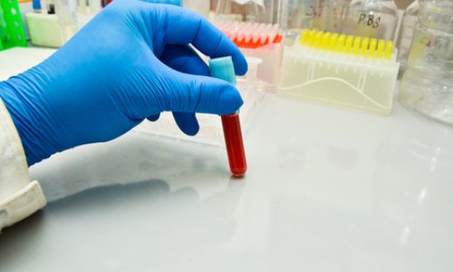 Pour un confinement total