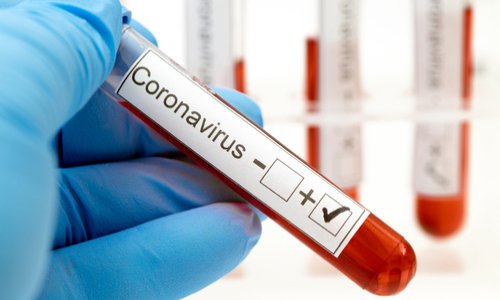 Pour être testé dès les premiers symptômes du Covid19 et être reconnu comme infecté !