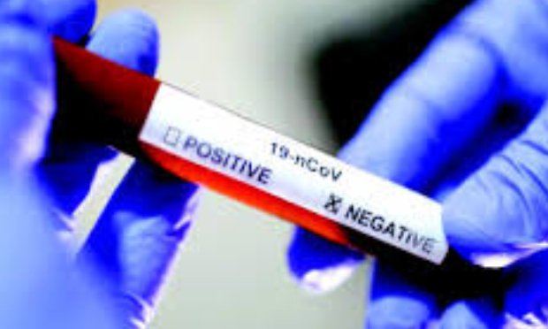 Pour le dépistage du Coronavirus pour tous !