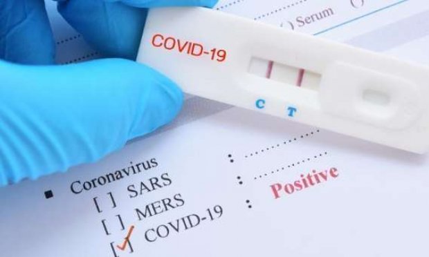 Appel à faire de l'Alsace le pilote des tests de dépistage du Covid-19 à grande échelle !