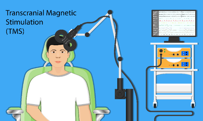 Prise en charge des séances de TMS (stimulation magnétique trans-crânienne)