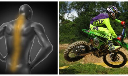 Selon vous et votre expérience, à quel étage précis du dos, vos douleurs apparaissent elles le plus souvent durant la pratique du moto cross ?