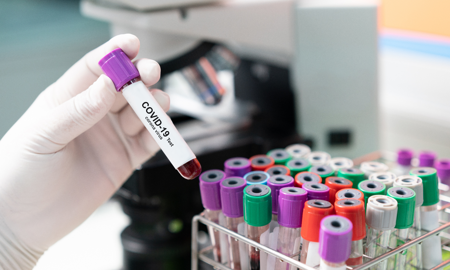 Covid-19, dépistages et tests : souhaitez-vous être testés avant le 11 mai ?