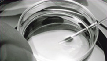 Êtes-vous favorable à l’utilisation de cellules-souches pour stopper les maladies incurables SLA en France ?