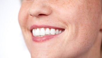 Quelle zone de pigmentation vous cause le plus de soucis en maquillage permanent ?