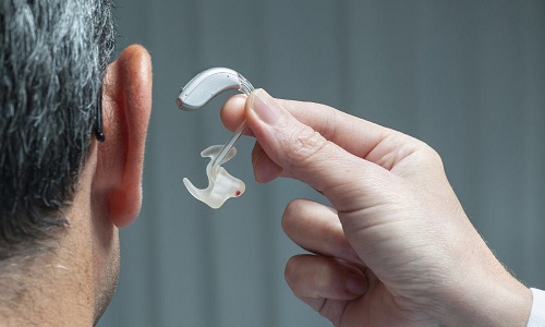 Audition : les candidats baisseront-ils la facture ?